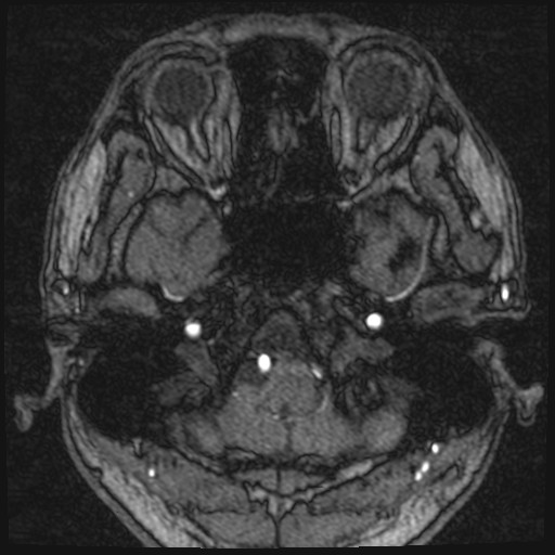 Click on the Serie image to view the images of VILLANUEVA, WILLIAM A.